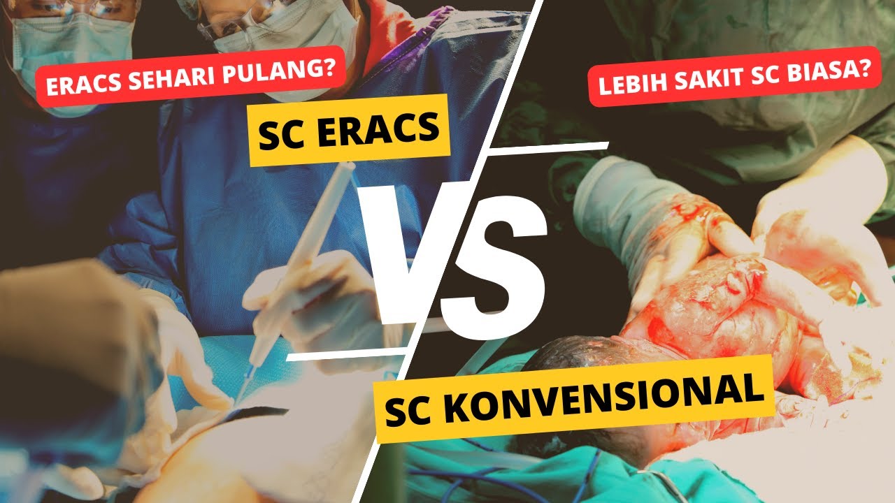 Perbedaan SC ERACS dengan SC biasa