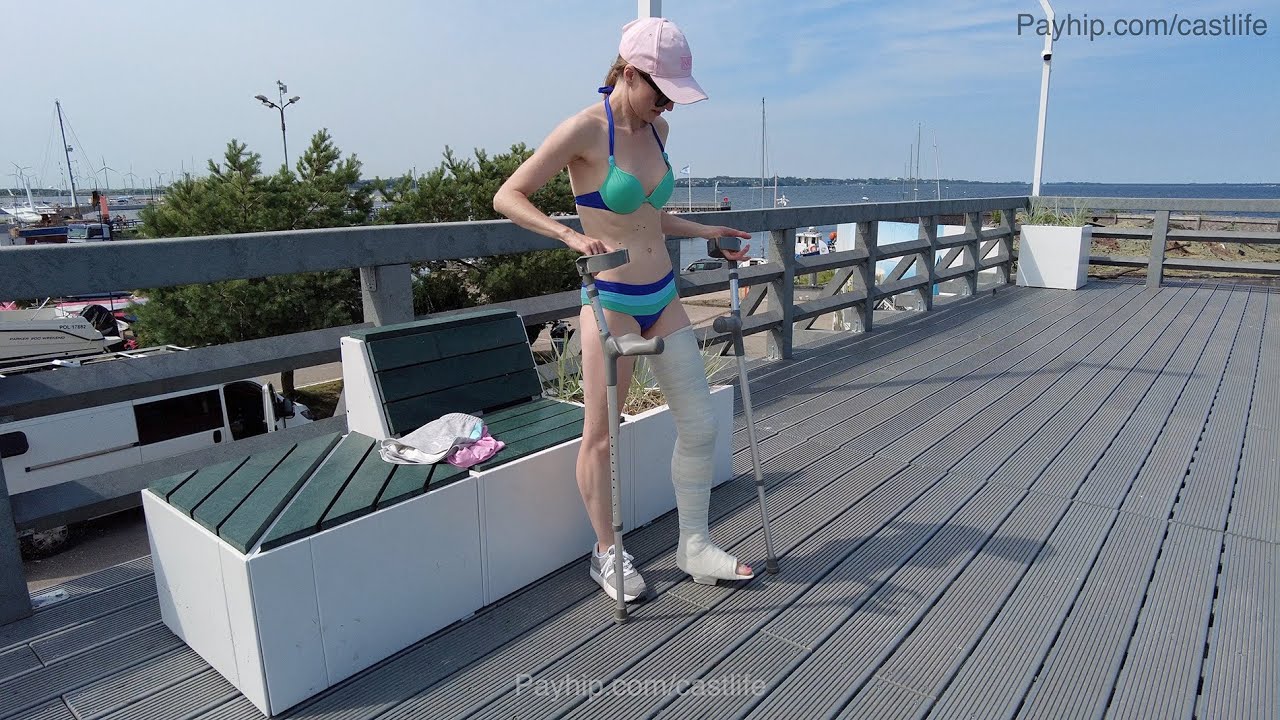Girl on vacation with a huge cast on her leg LLWC TOEPLATE