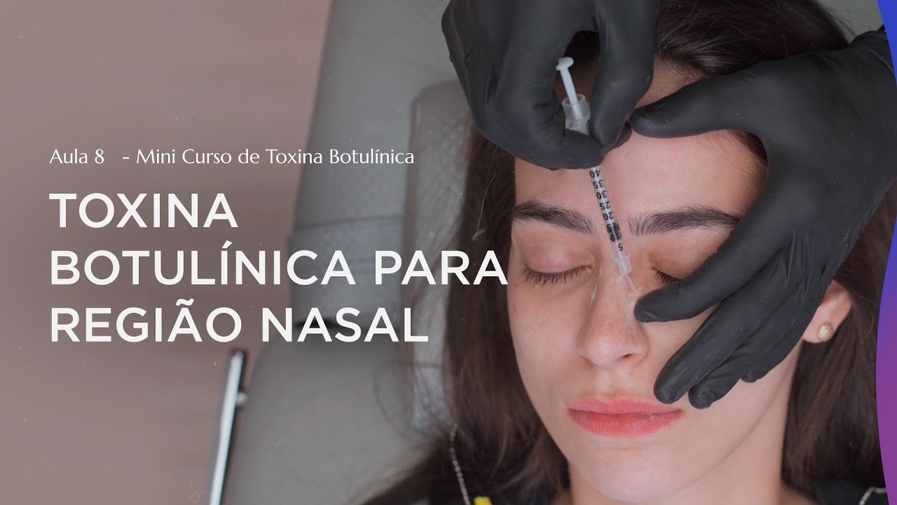 Aula 8 - Como fazer aplica&ccedil;&atilde;o de Toxina Botul&iacute;nica na regi&atilde;o Nasal