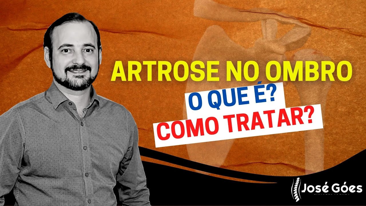 Artrose no ombro: o que é e como tratar | José Góes