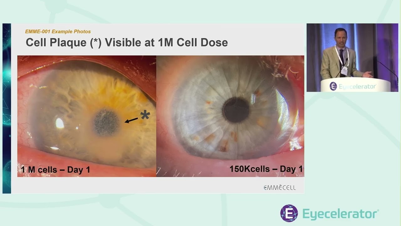 Eyecelerator @ AAO 2025 | Anterior Segment Showcase: Emmecell