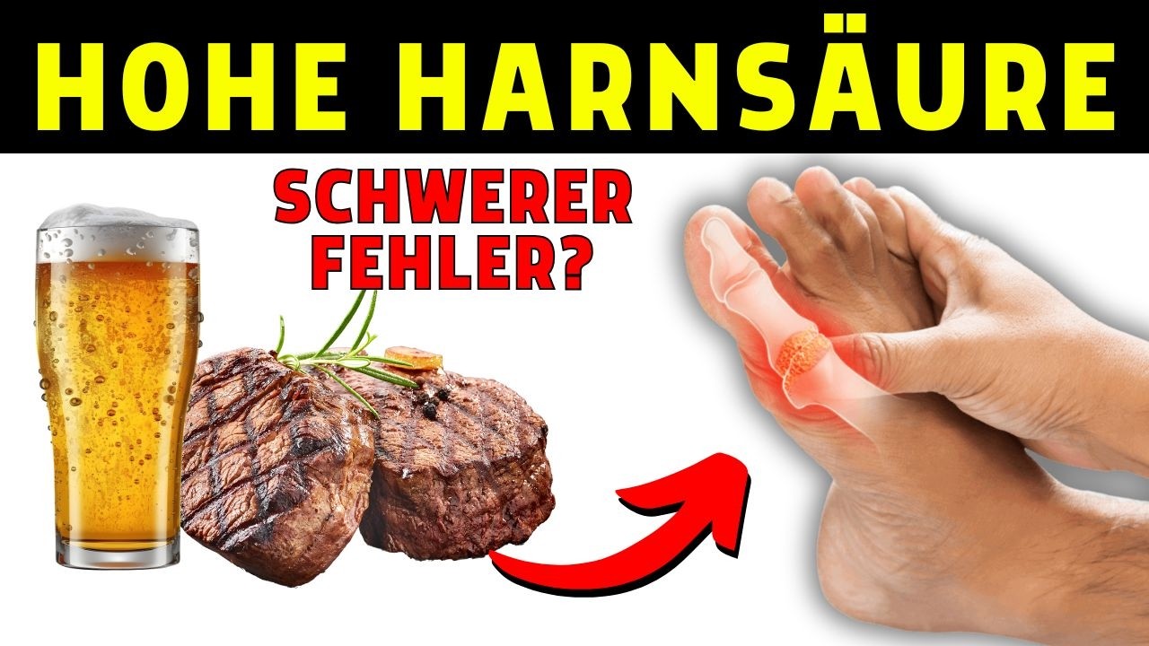 5 Lebensmittel, die Sie bei hohem Harns&auml;ure meiden sollten