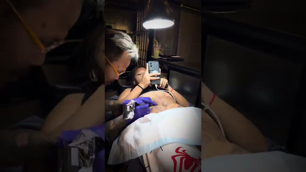สักลายปิดทับแก้ปัญหาท้องลายหลังตลอด   Dragon king tattoo จัดให้ สร้างความมั่นใจไปอีกขั้น 