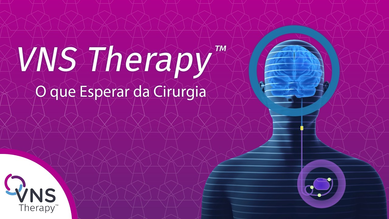Terapia VNS: Como é o Procedimento de Implante e o Que Esperar