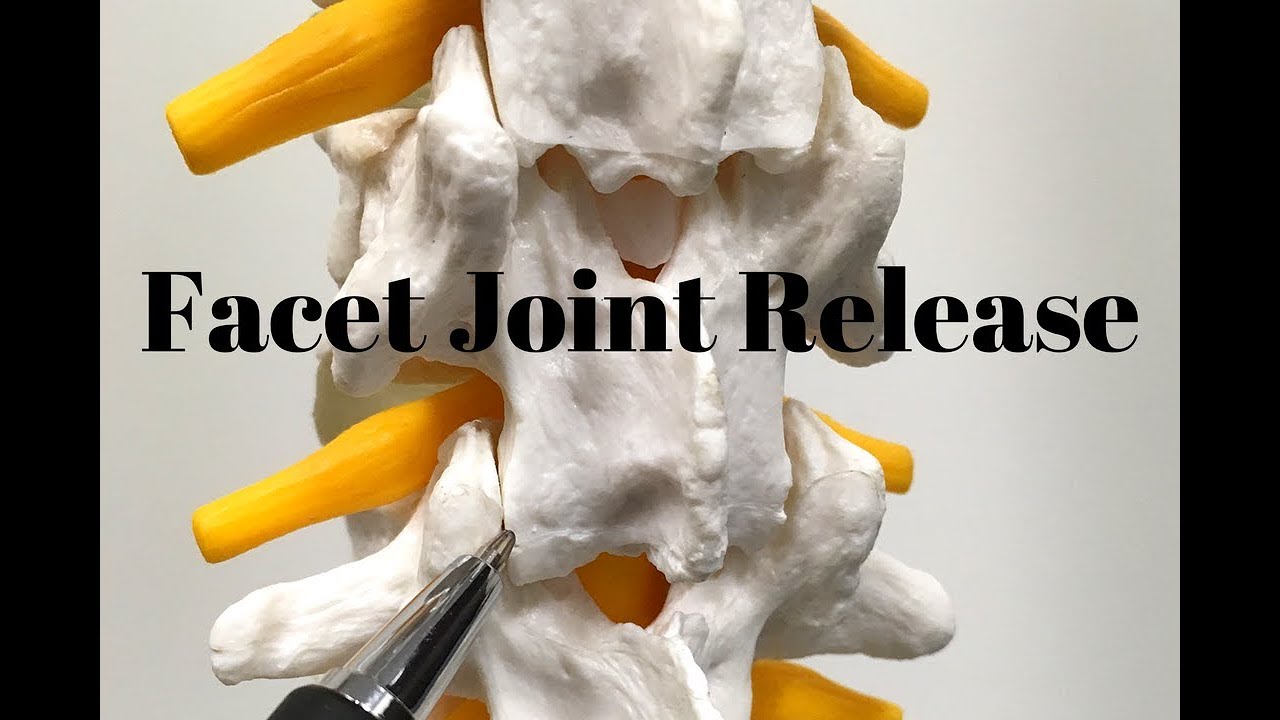 Facet Syndrome Release