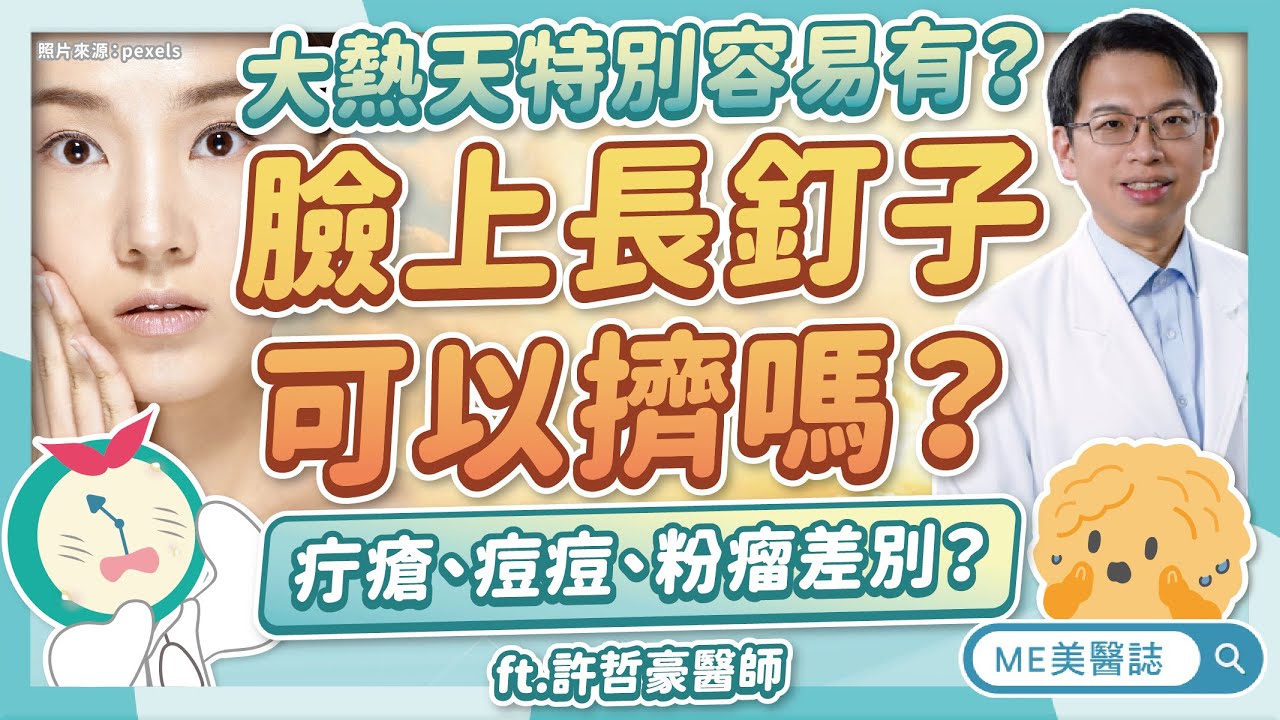 臉上細菌感染「長釘子」了？疔瘡、痘痘、粉瘤差別？疔瘡治療要引流？ft.許哲豪醫師【ME美醫誌】