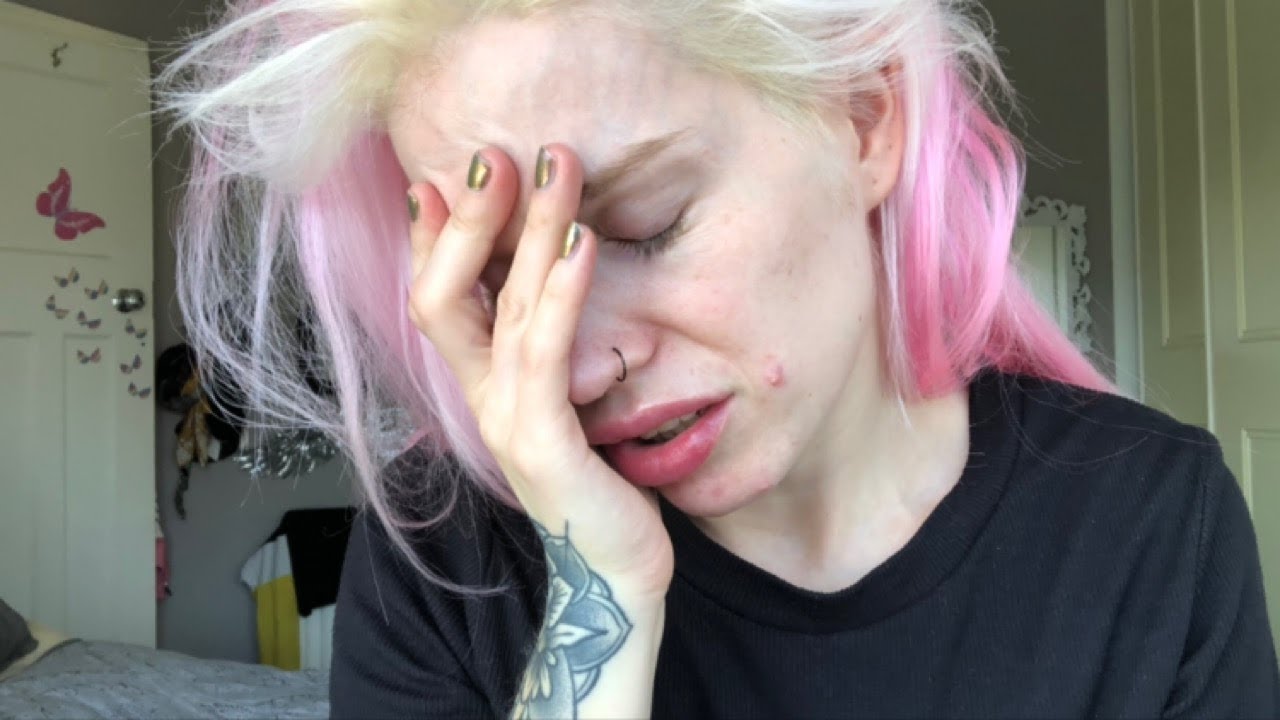 What i wished i knew before having BOTOX & WHY I'LL NEVER GET IT AGAIN