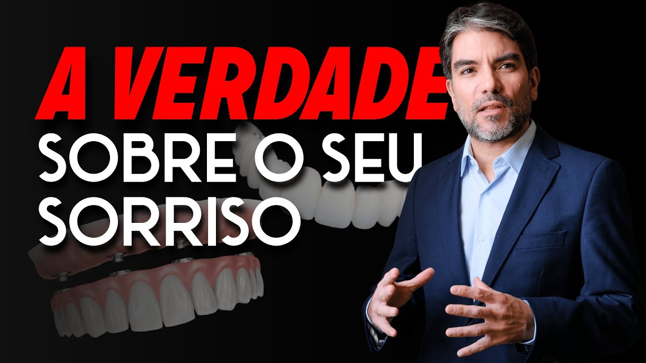 Os 2 Tipos de Prótese Protocolo (NÃO ESCOLHA antes de ver isso)