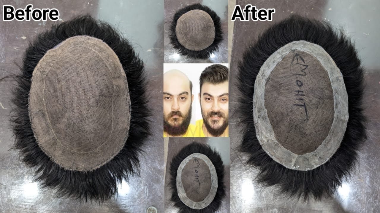 Hair patch Border Repair,Call me Now +917982977328