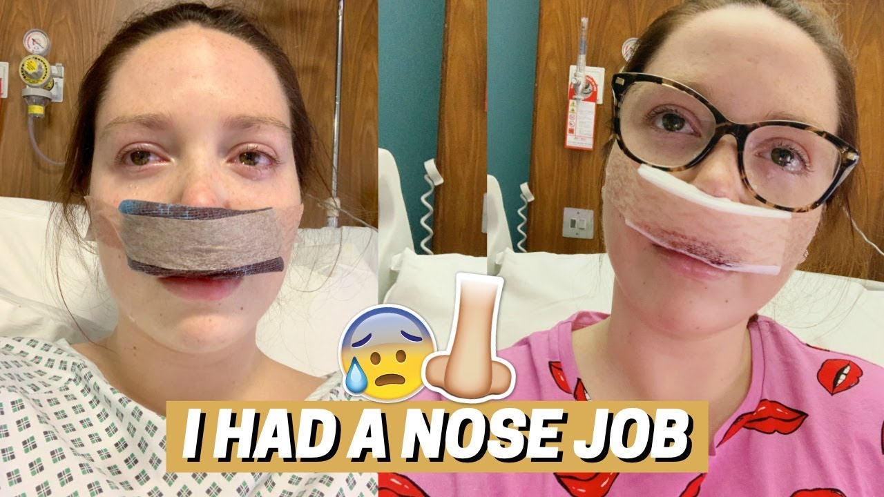 I HAD A NOSE JOB 😐 - Feel Free To Laugh At Me -