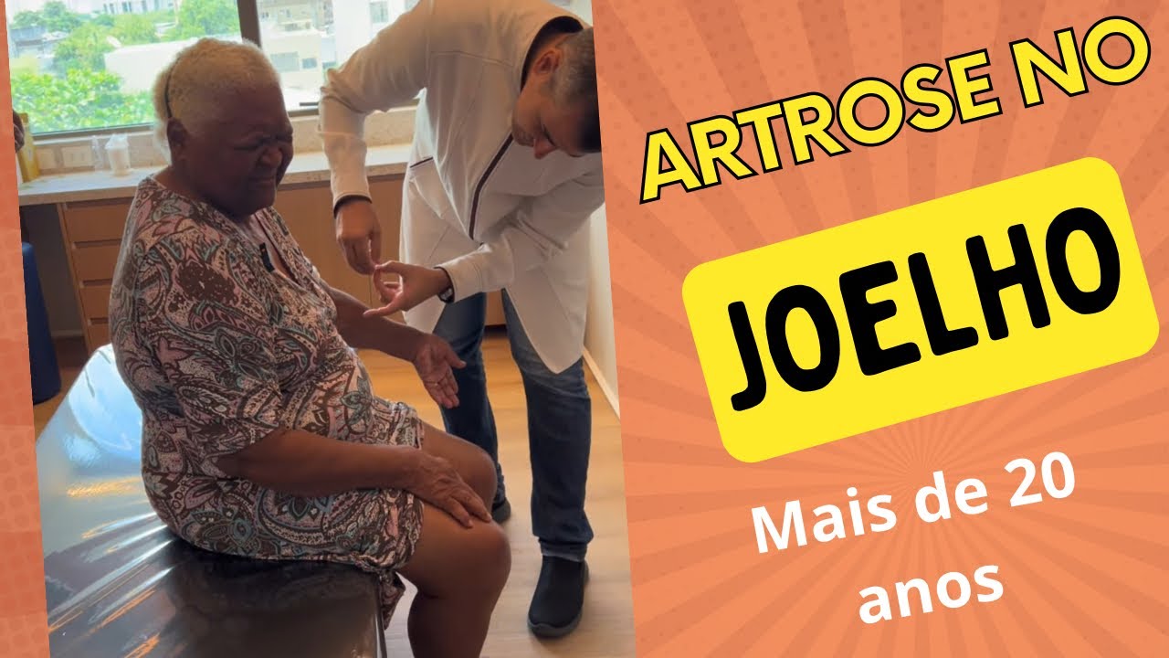 ARTROSE JOELHO HÁ MAIS DE 20 ANOS - TRATAMENTO #acupuntura #artrose #dornojoelho