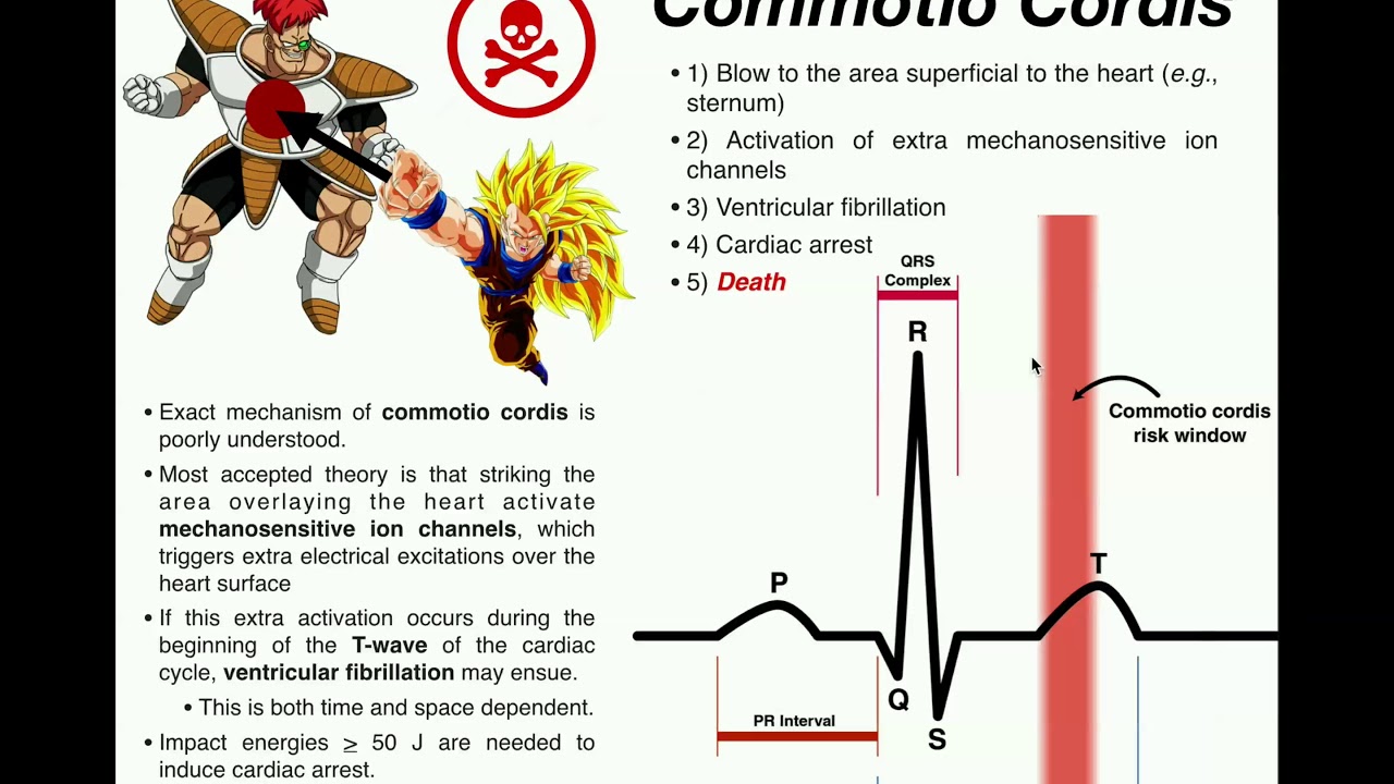 The Mechanism of Commotio Cordis