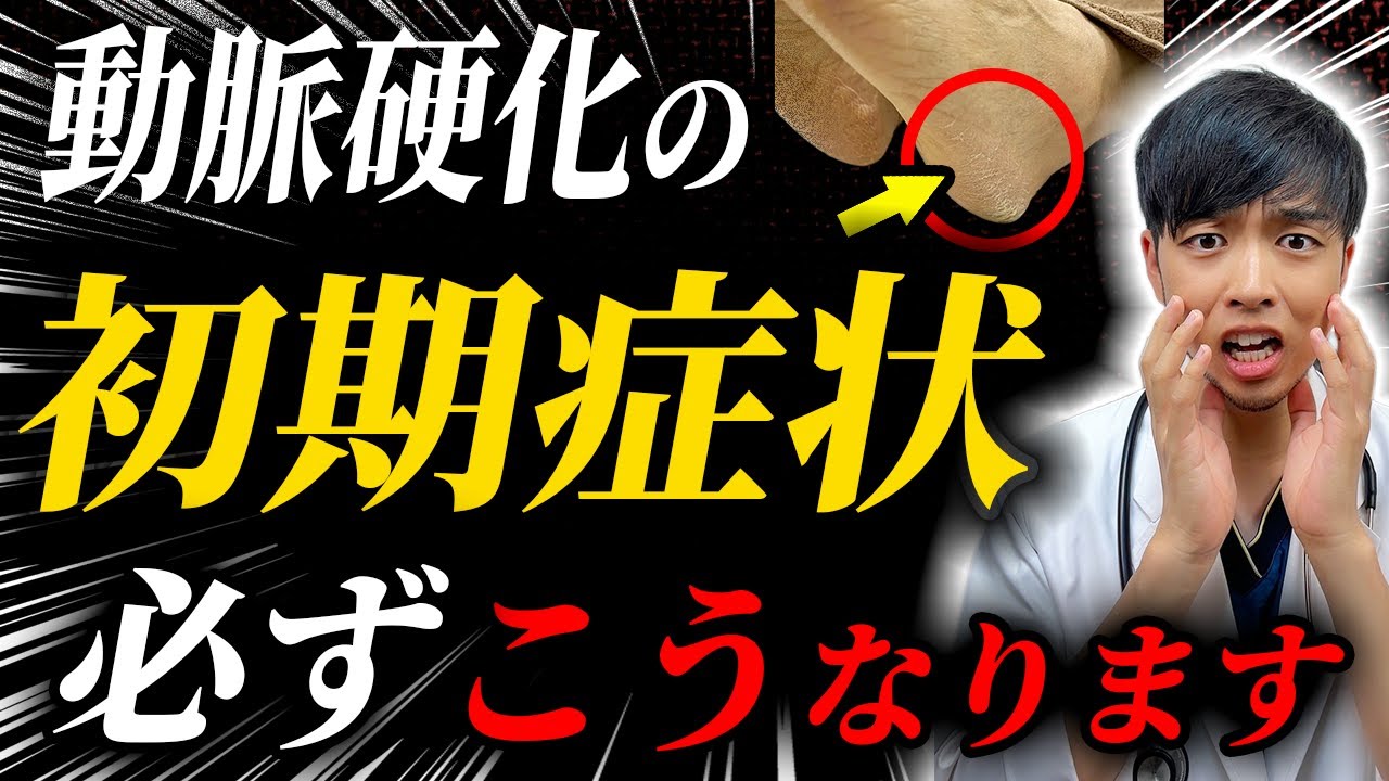 【警告】足のそのサイン、がんより怖い動脈硬化の始まりです。放置すると心筋梗塞・脳梗塞へ…今すぐできるセルフチェック法
