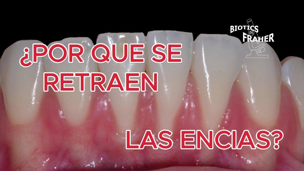 ¿POR QUE SE RETRAEN LAS ENCIAS?