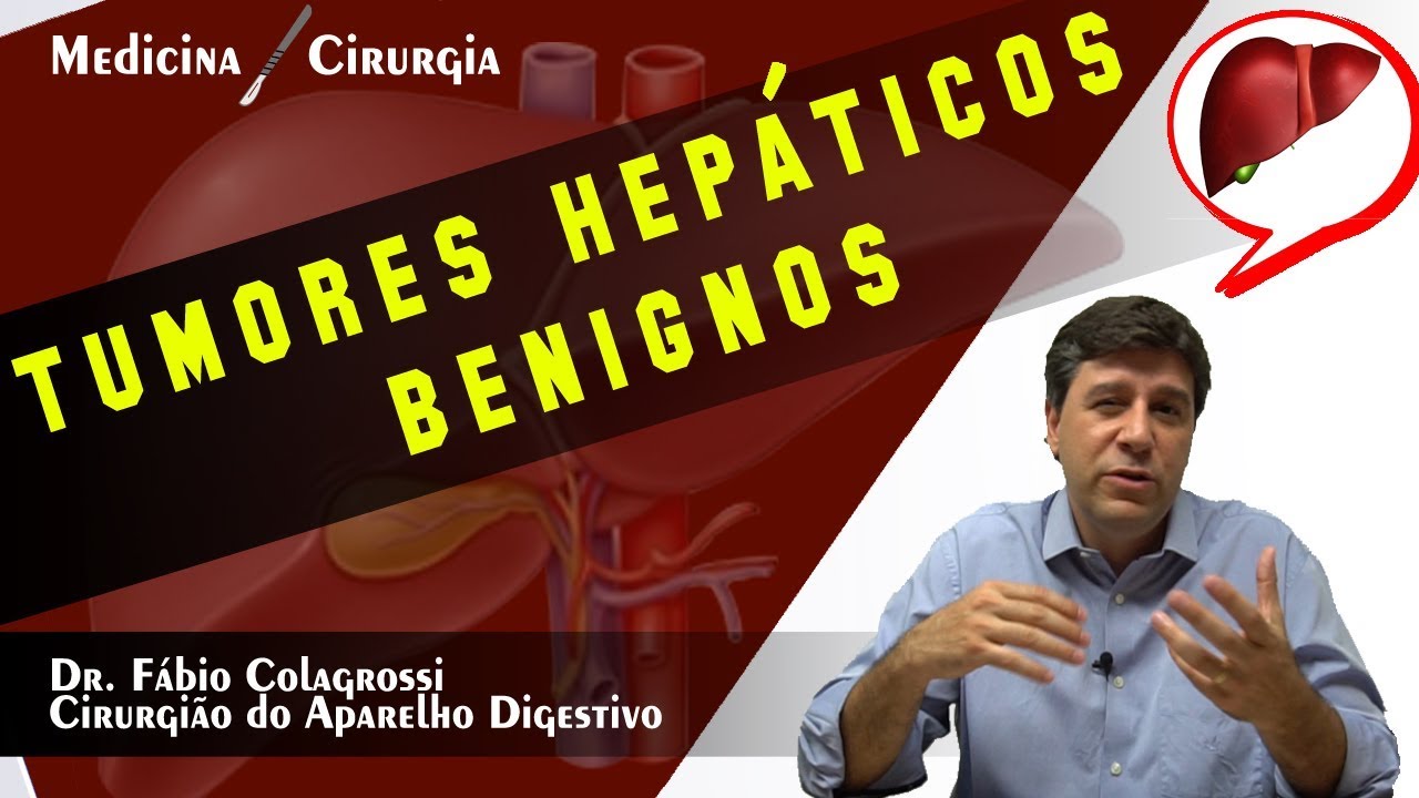 TUMORES HEP&Aacute;TICOS BENIGNOS