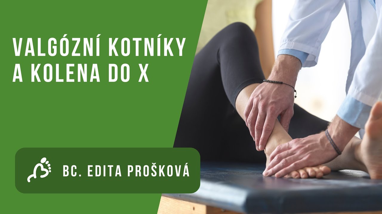 Bc. Edita Prošková: Valgózní kotníky a kolena do X