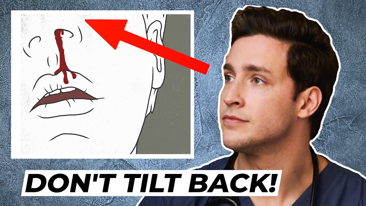 Doctor’s Trick to Stop A Bloody Nose | Responding To Comments