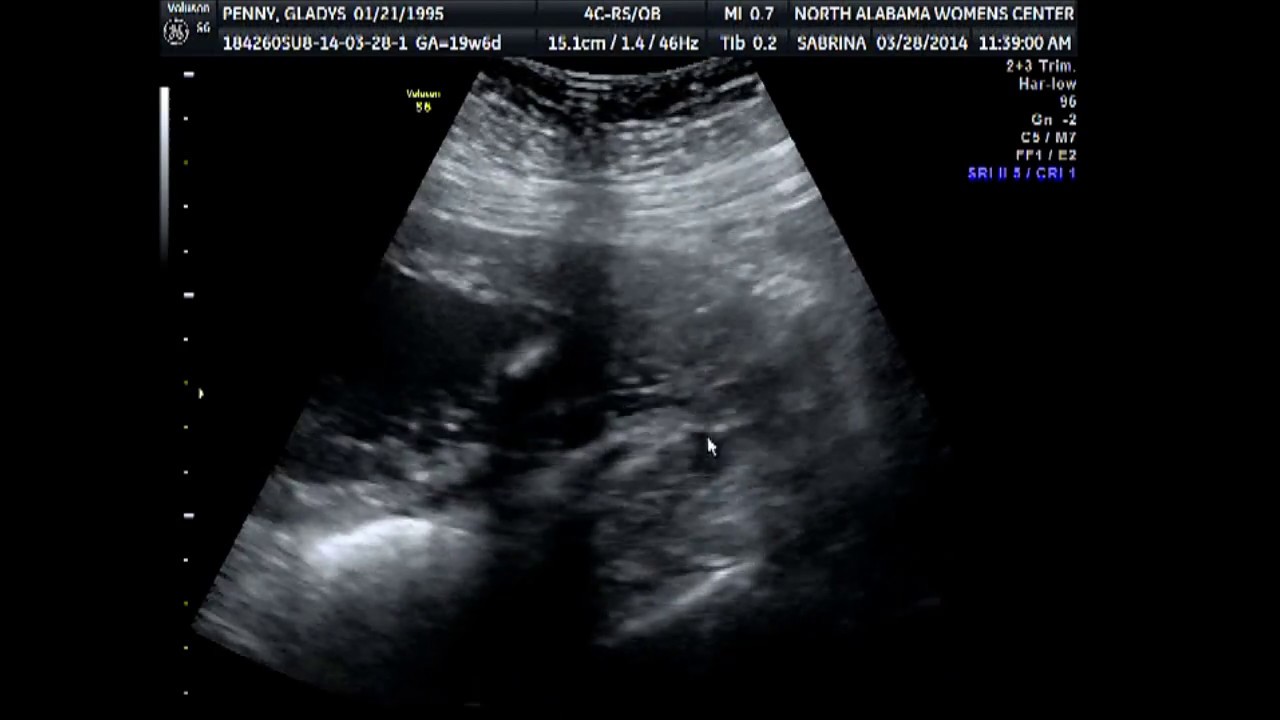 Penny Baby - Coming Soon to a Family Near You!