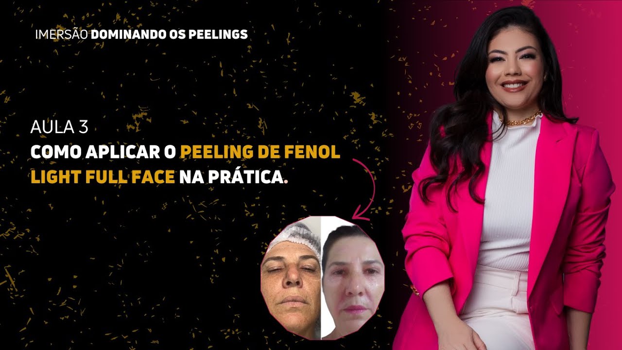AULA 3: Como aplicar peeling de fenol light full face na prática.