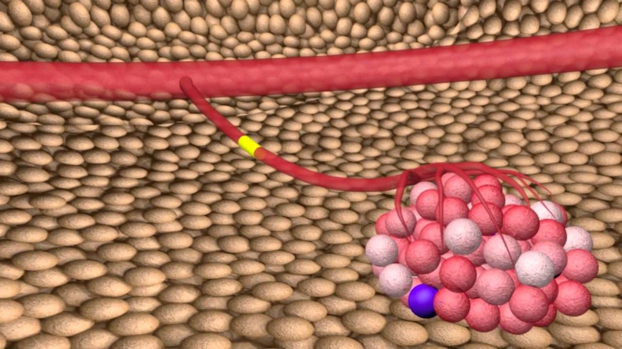 The Cancer Stem Cell Theory