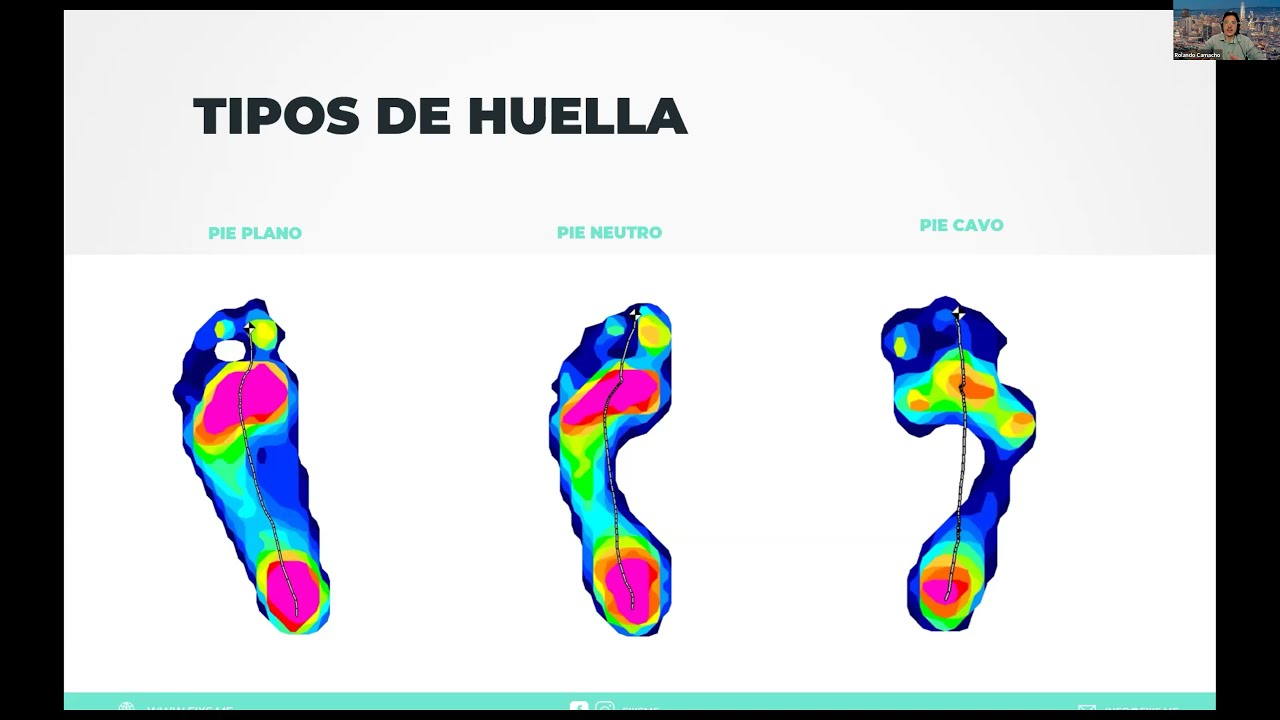 WEBINAR La importancia de la baropodometria