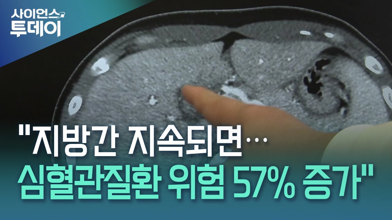 "지방간 지속되면…심혈관질환 위험 57% 증가" / YTN 사이언스