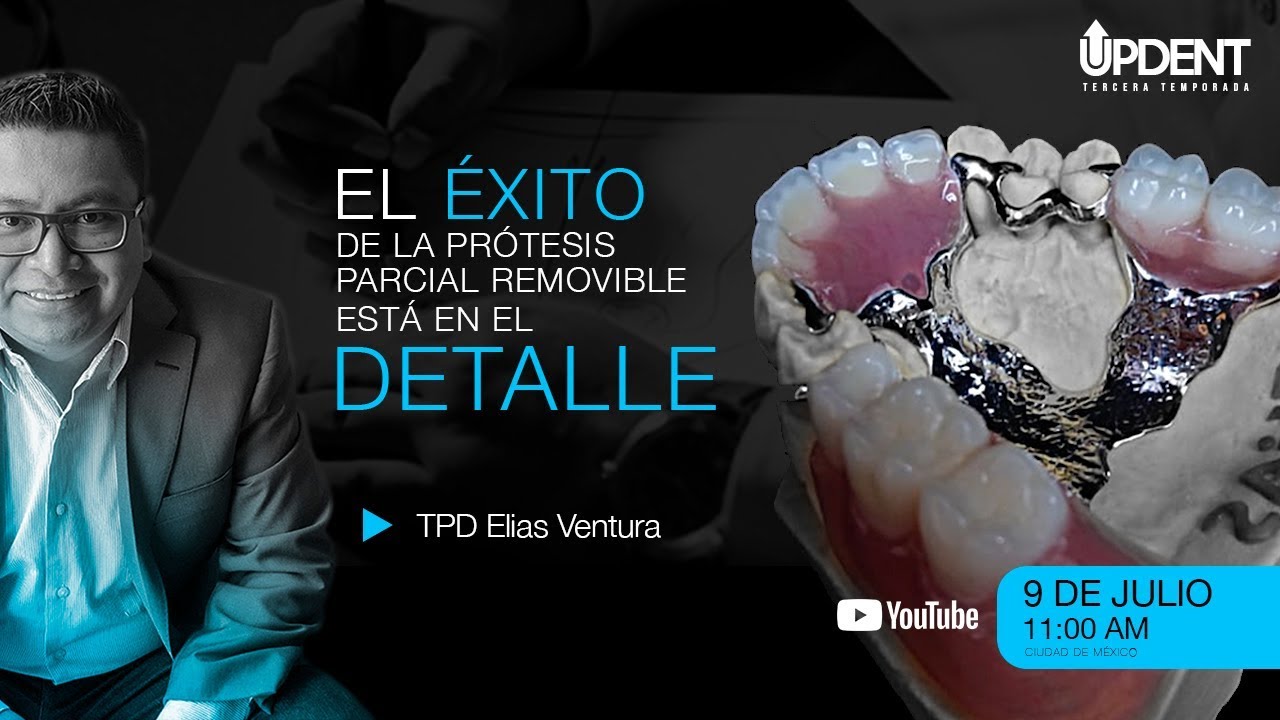 El éxito de la P.P.R. está en el detalle.