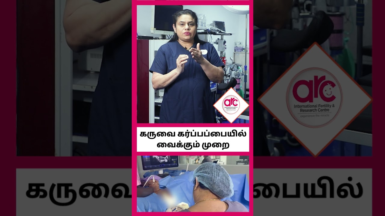 Embryo Transfer Procedure Shorts | ARC Fertility Centre| ARC Fertility Hospitals