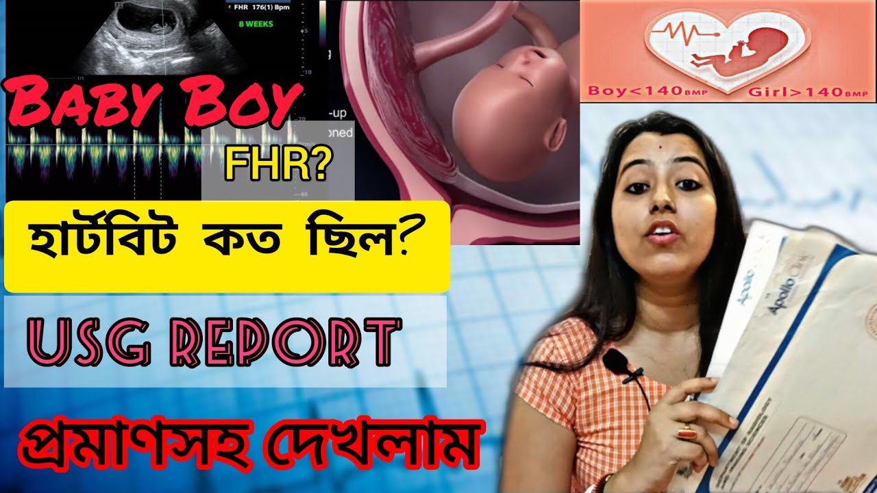 Heart beat (FHR) কত থাকলে Baby Boy হতে পারে? F আর M কোথায় লেখা থাকে? প্রমাণসহ দেখলাম আজ।।