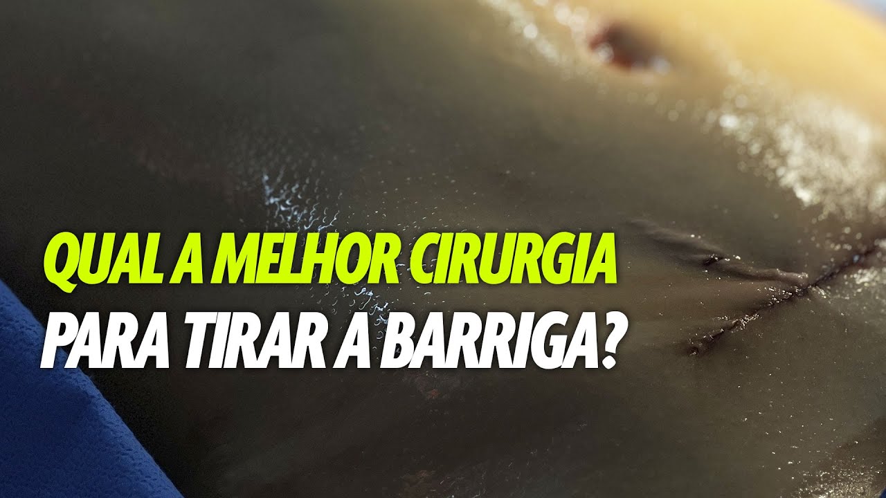 QUAL A MELHOR CIRURGIA PARA TIRAR A BARRIGA? CIRURGIA PLASTICA