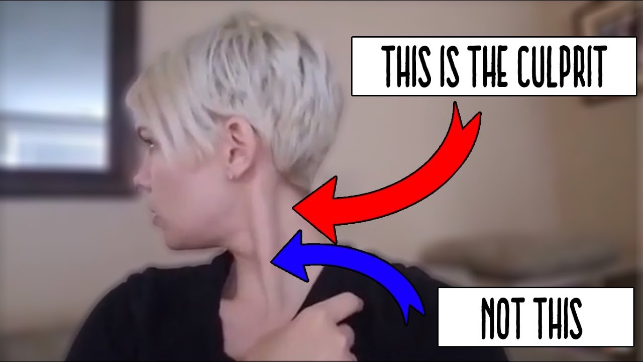Cervical Dystonia (head shaking) & Nystagmus (eye shaking)
