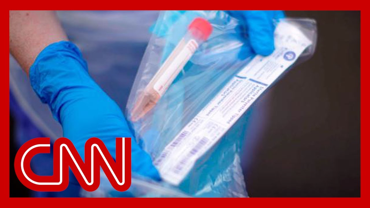 US overtakes Italy in total coronavirus cases
