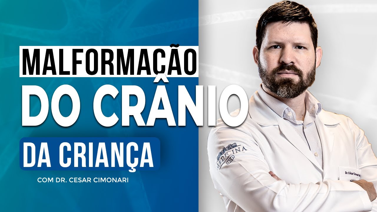 Malforma&ccedil;&atilde;o do Cranio da Crian&ccedil;a