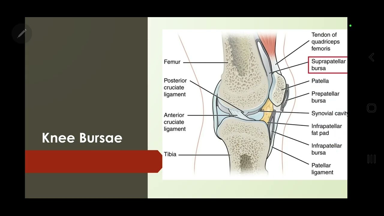 Bursitis- rheumatic conditions 