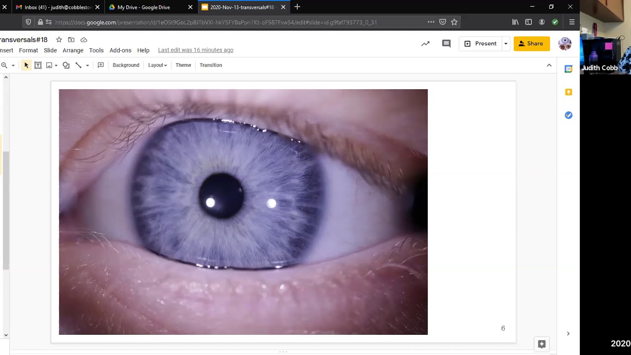 IRIDOLOGY: The question of fiber structure