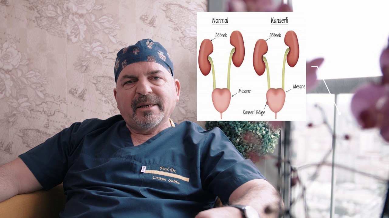 Mesane Kanserlerinde Mesaneyi Ne Zaman Alıyoruz? Prof. Dr. Coşkun Şahin