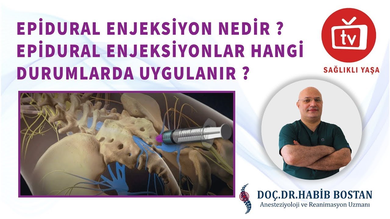EPİDURAL ENJEKSİYON NEDİR -BEL FITIĞI ENJEKSİYON TEDAVİSİ - DOÇ.DR.HABİB BOSTAN