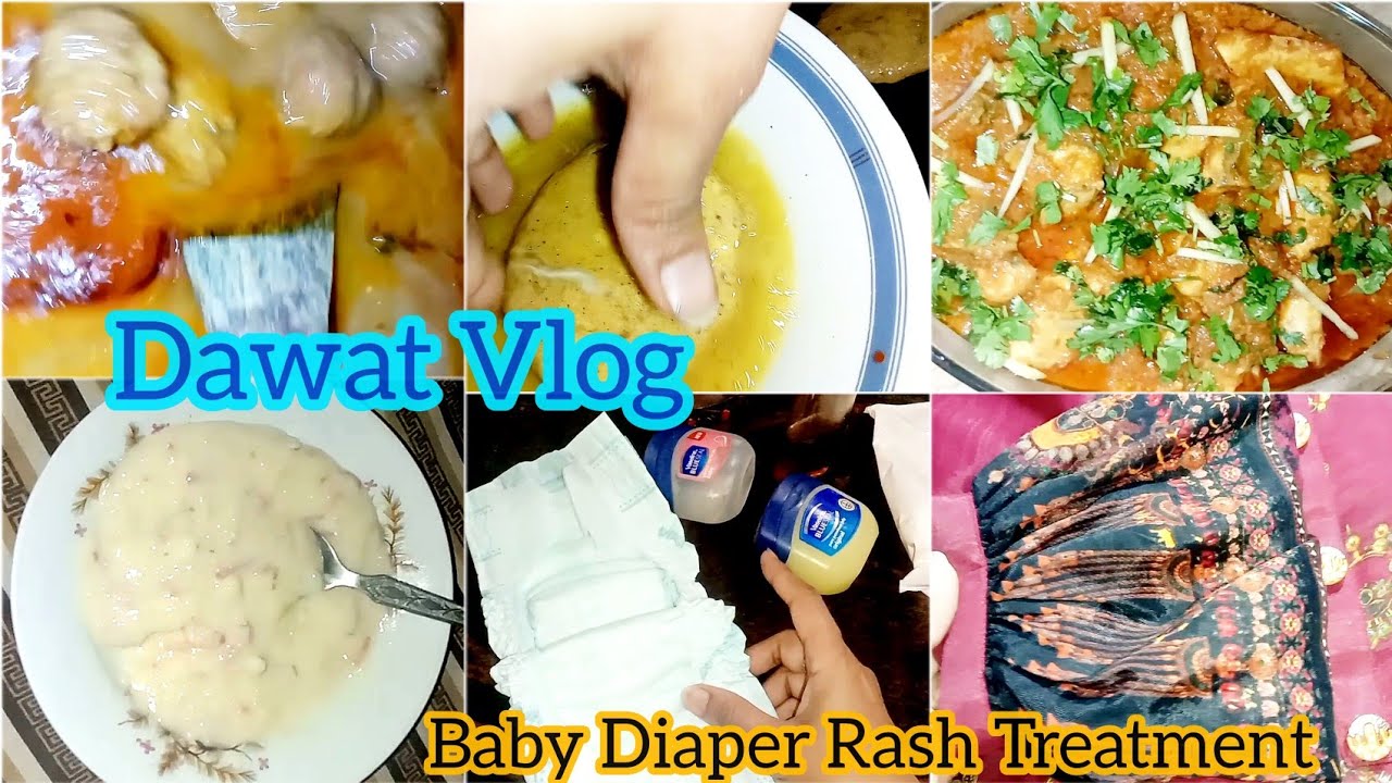 Baby Diaper Rash Treatment | Bachun k rashes khatm krny k ghrelo nuskhy | #dawatvlog #vlog #babyboy