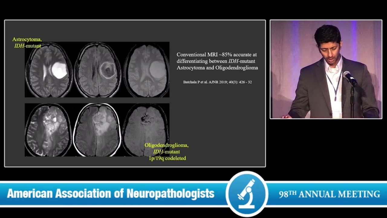 What Every Neuropathologist Needs to Know: Adult Diffuse Glioma: The Neuroradiologist Perspective