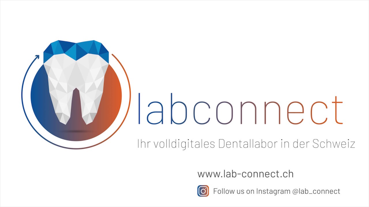 Digitale Abformung - Datenversand (Labconnect AG)