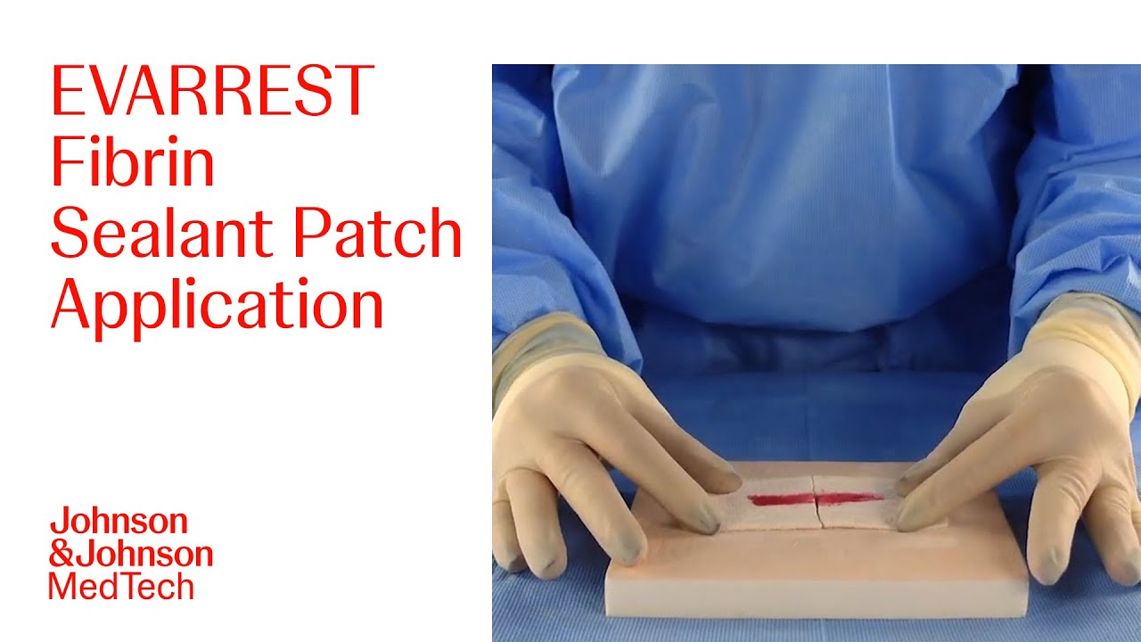 How to Use EVARREST Fibrin Sealant Patch for Surgical Bleeding Management | J&J MedTech