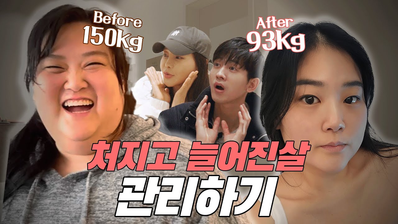 60kg 감량하고 늘어진 살 생애 첫 시술 받으러간 미나 시누이 😲 과연 시술 결과는??