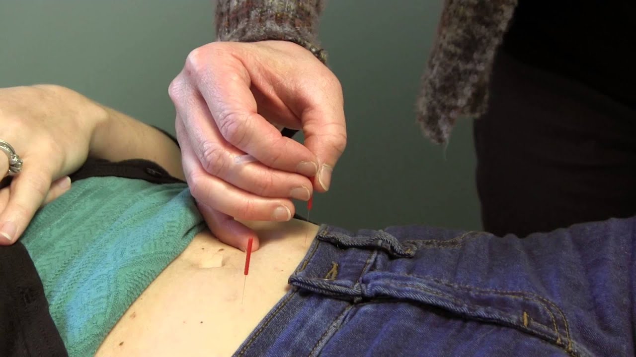 Acupuncture treatment for infertility