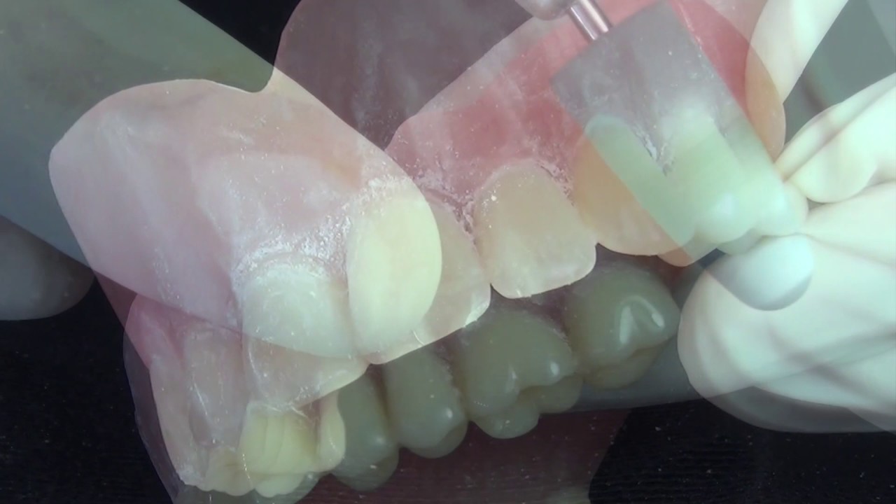 Идеальная полировка протезов  Jota Kit Denture Base 8 инструментов
