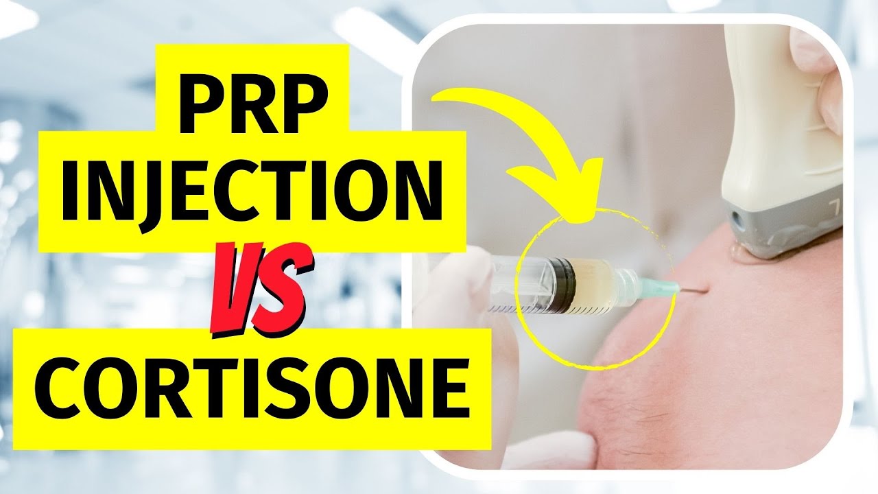 Tennis Elbow Injection - PRP vs Cortisone