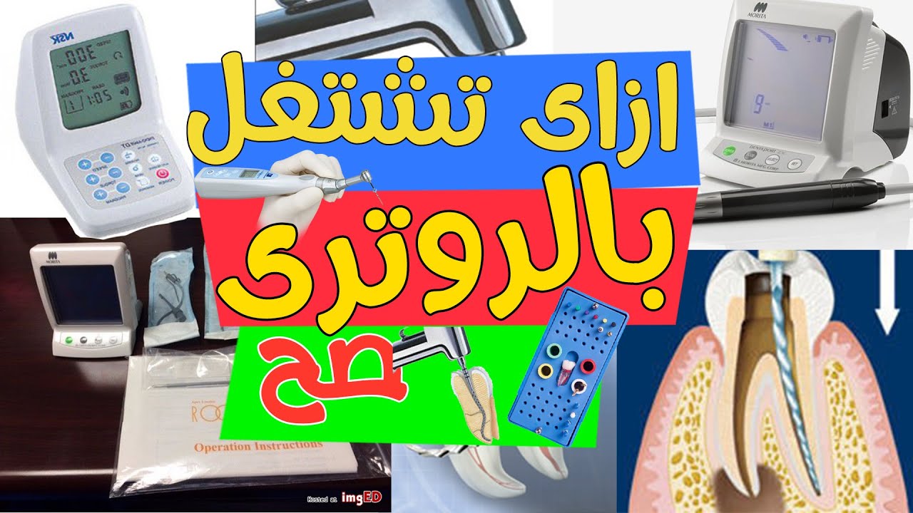 Mechanical Preparation with Rotary File || Coronal Flaring