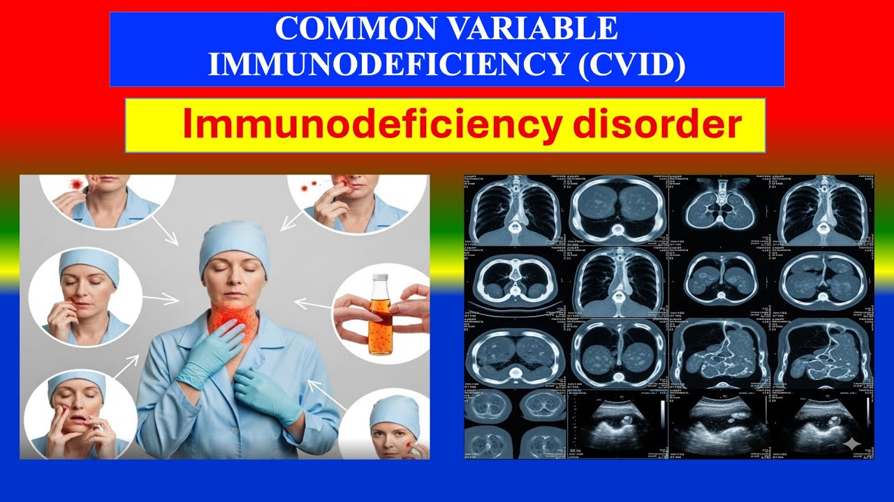COMMON VARIABLE IMMUNODEFICIENCY (CVID) Explained | Causes, types, Symptoms, Diagnosis & Treatment&rdquo;