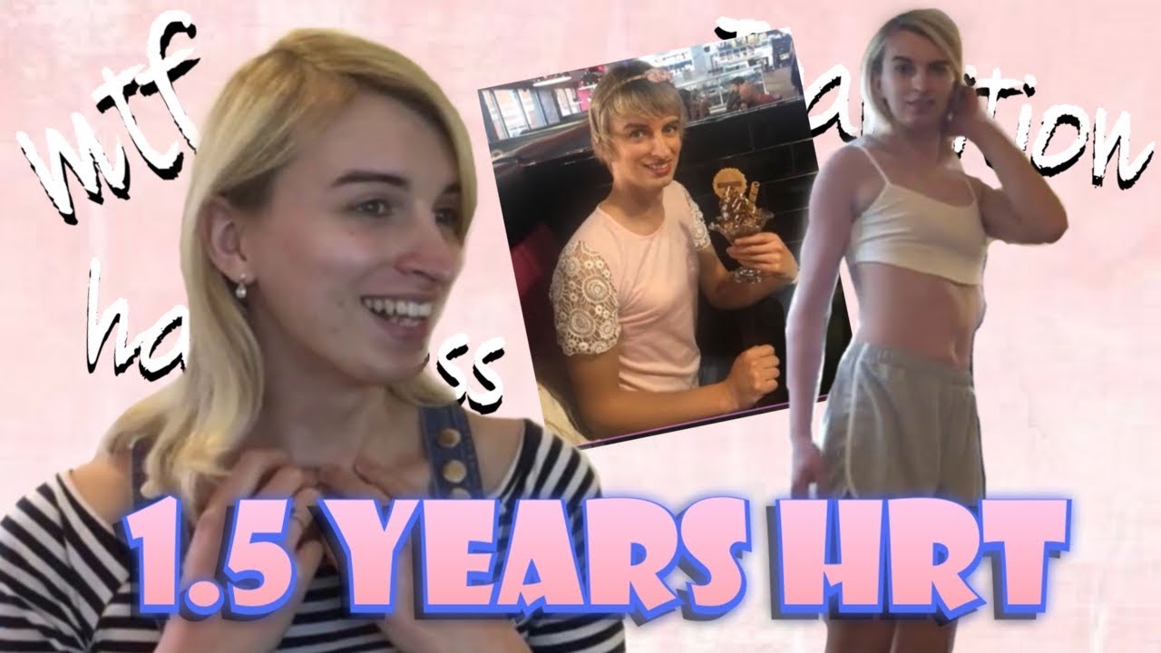 1.5 Years on Hormones - MtF Look How Much Has Changed in 6 Months!