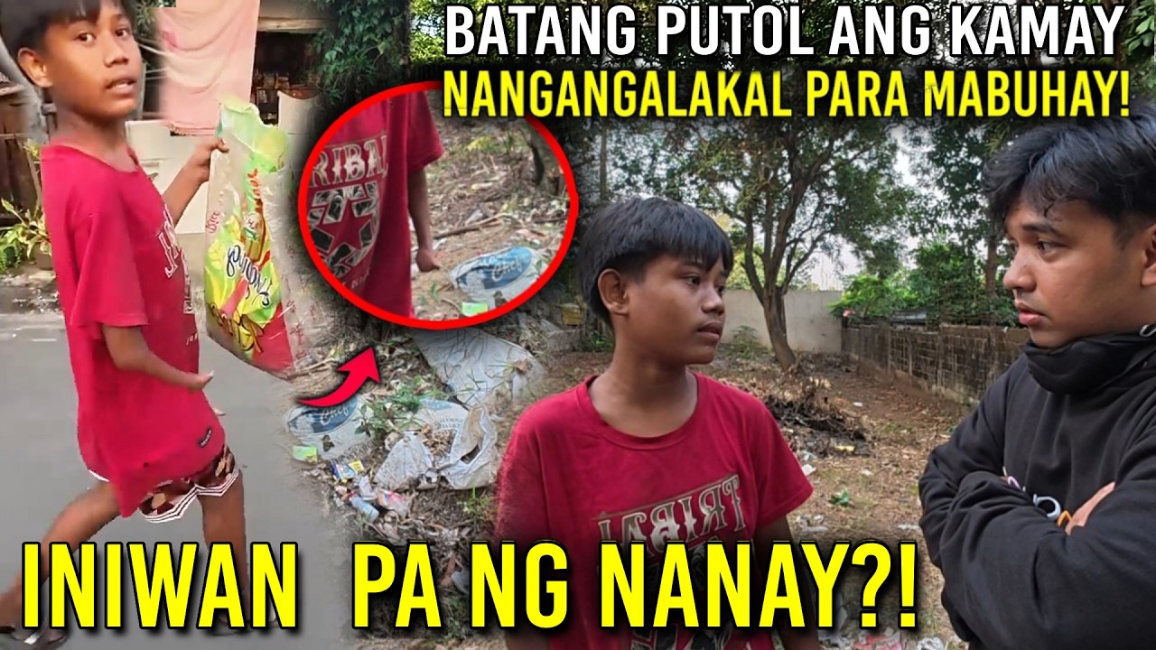 BATANG SAMAR PUTOL ANG KAMAY NANGANGALAKAL PARA MABUHAY! INIWAN PA NG NANAY?!