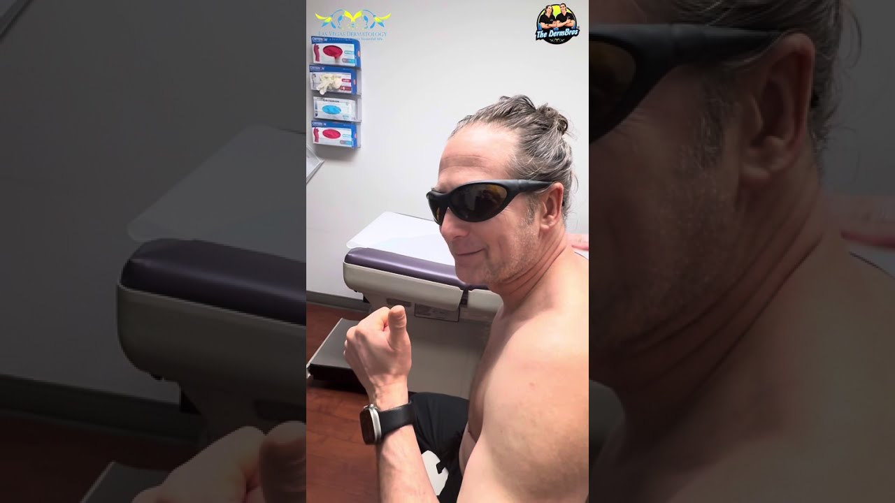 Long Form Laser Hair Removal Video 💥📹 at Las Vegas Dermatology®.